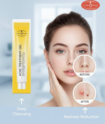 Aichun Beauty - Acne Treatment Gel