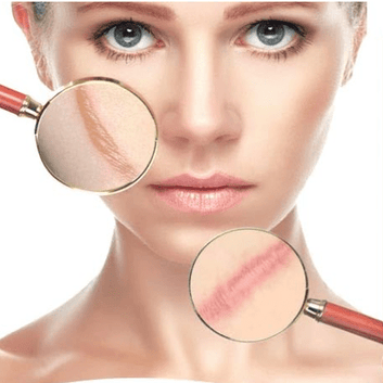 Aichun Beauty - Scar Removal Gel